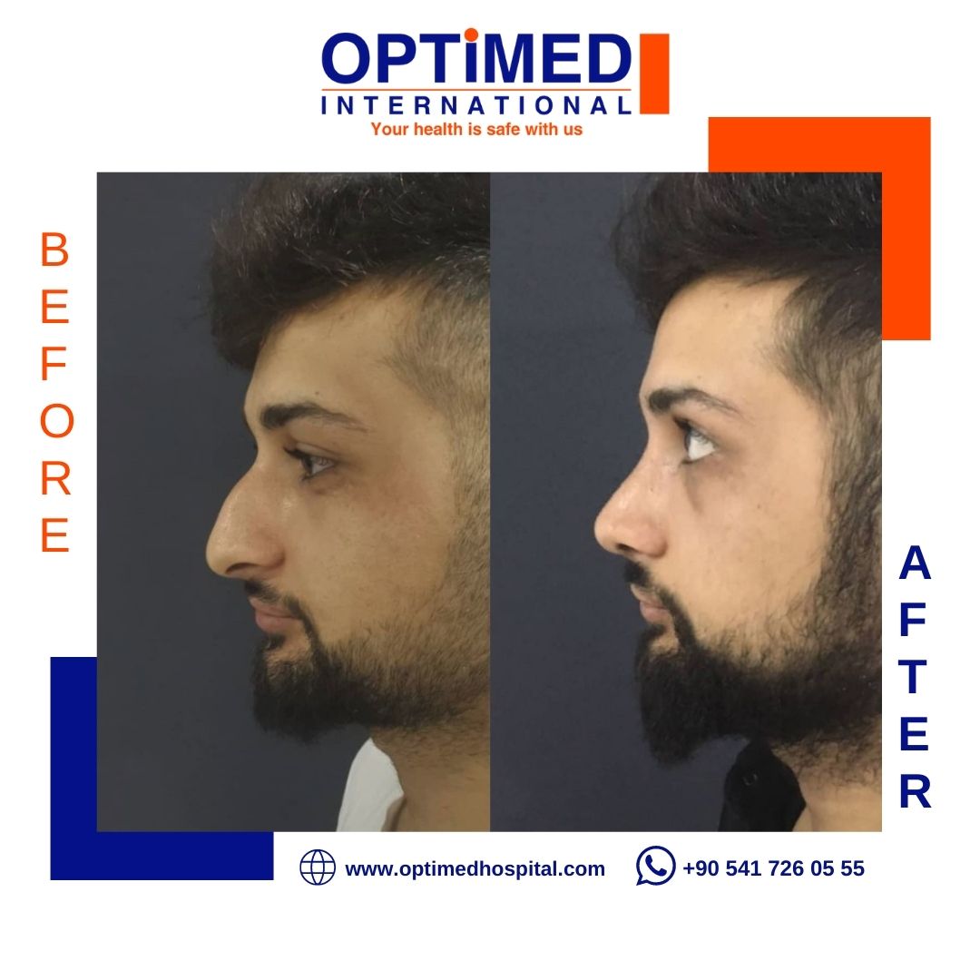 Estetică facială — sonuç 4