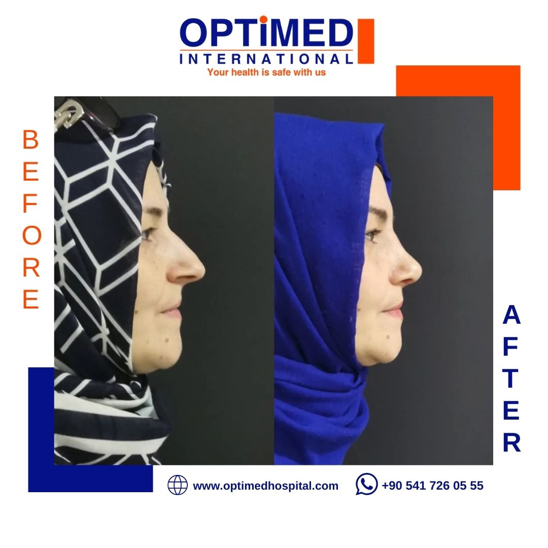 Estetică facială — sonuç 5