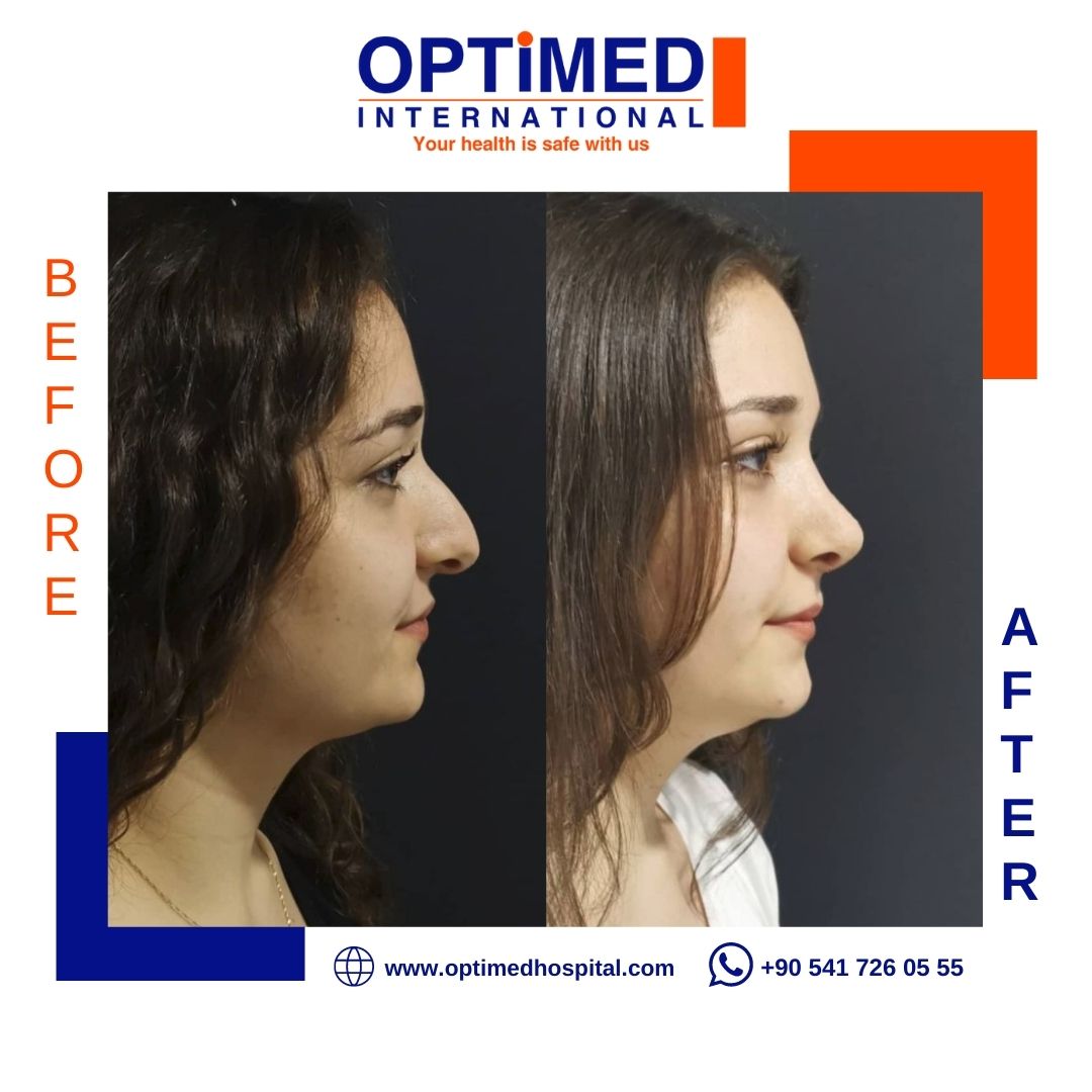 Estetică facială — sonuç 6