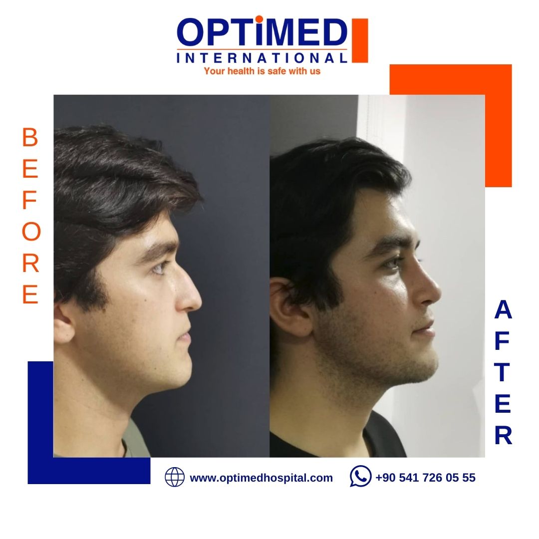 Estetică facială — sonuç 7