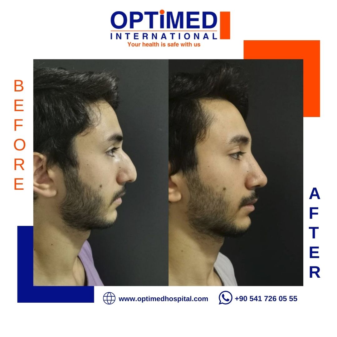 Estetică facială — sonuç 8