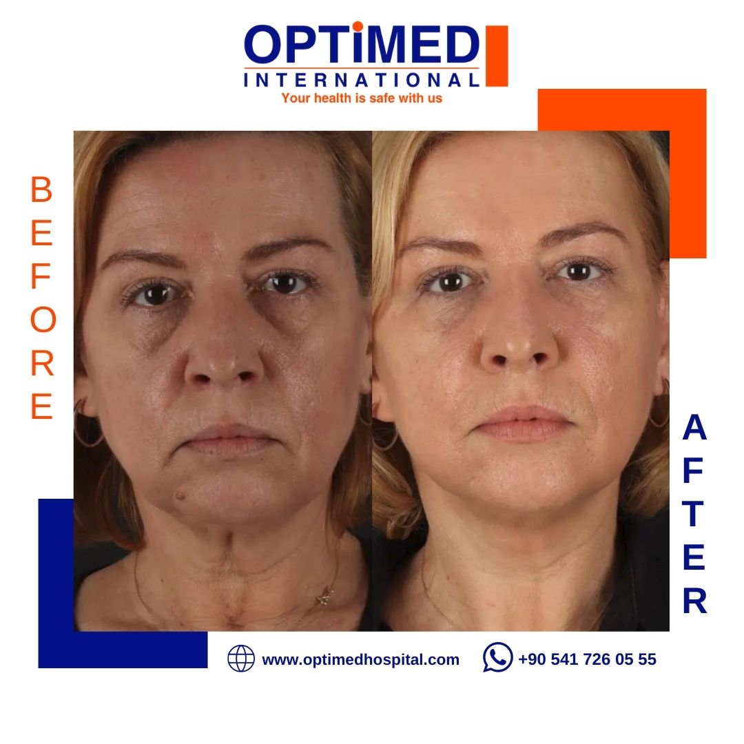 Estetică facială — sonuç 10