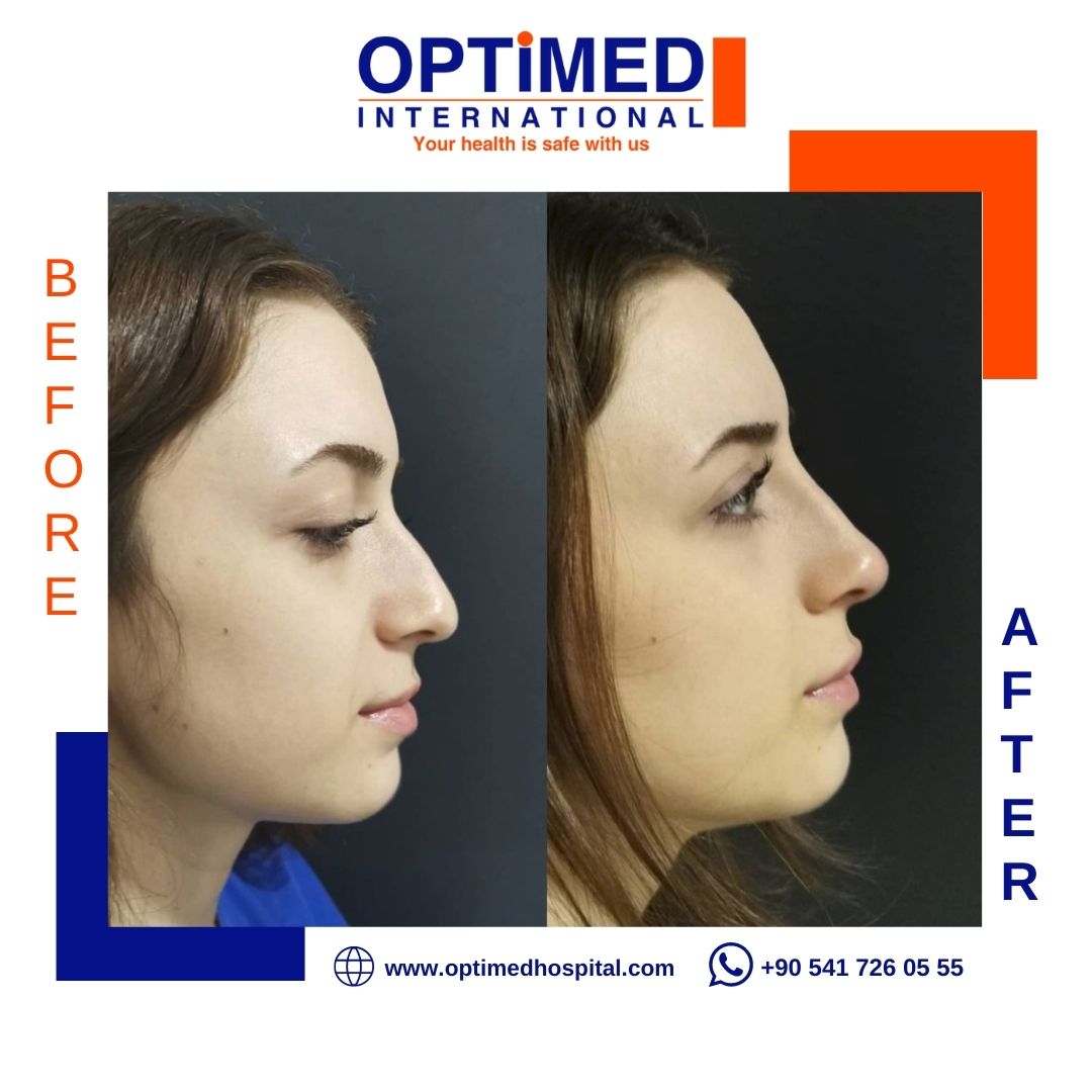 Estetică facială — sonuç 11