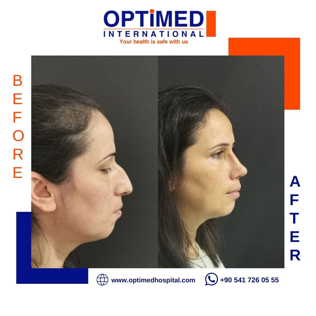 Estetică facială — sonuç 12