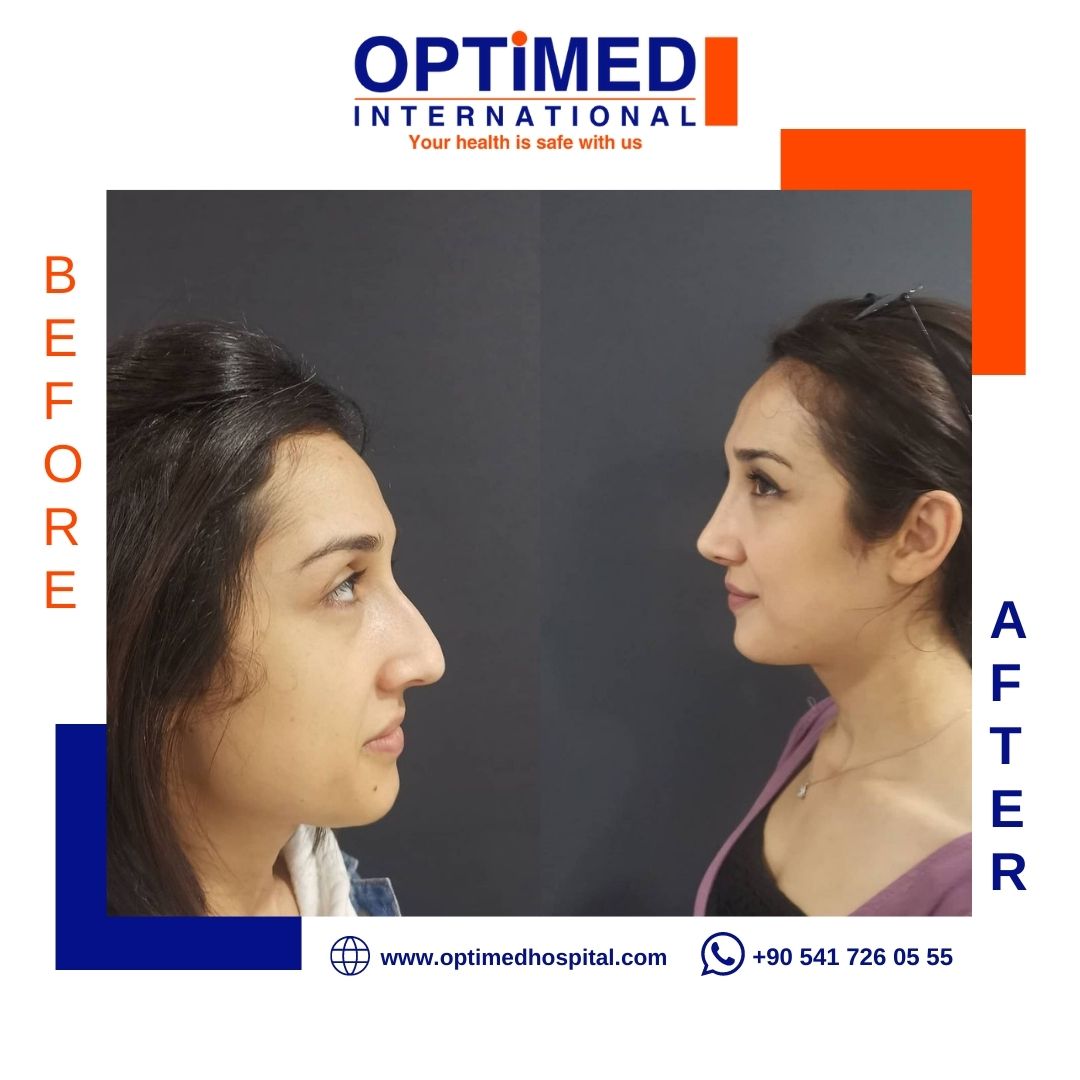 Estetică facială — sonuç 13