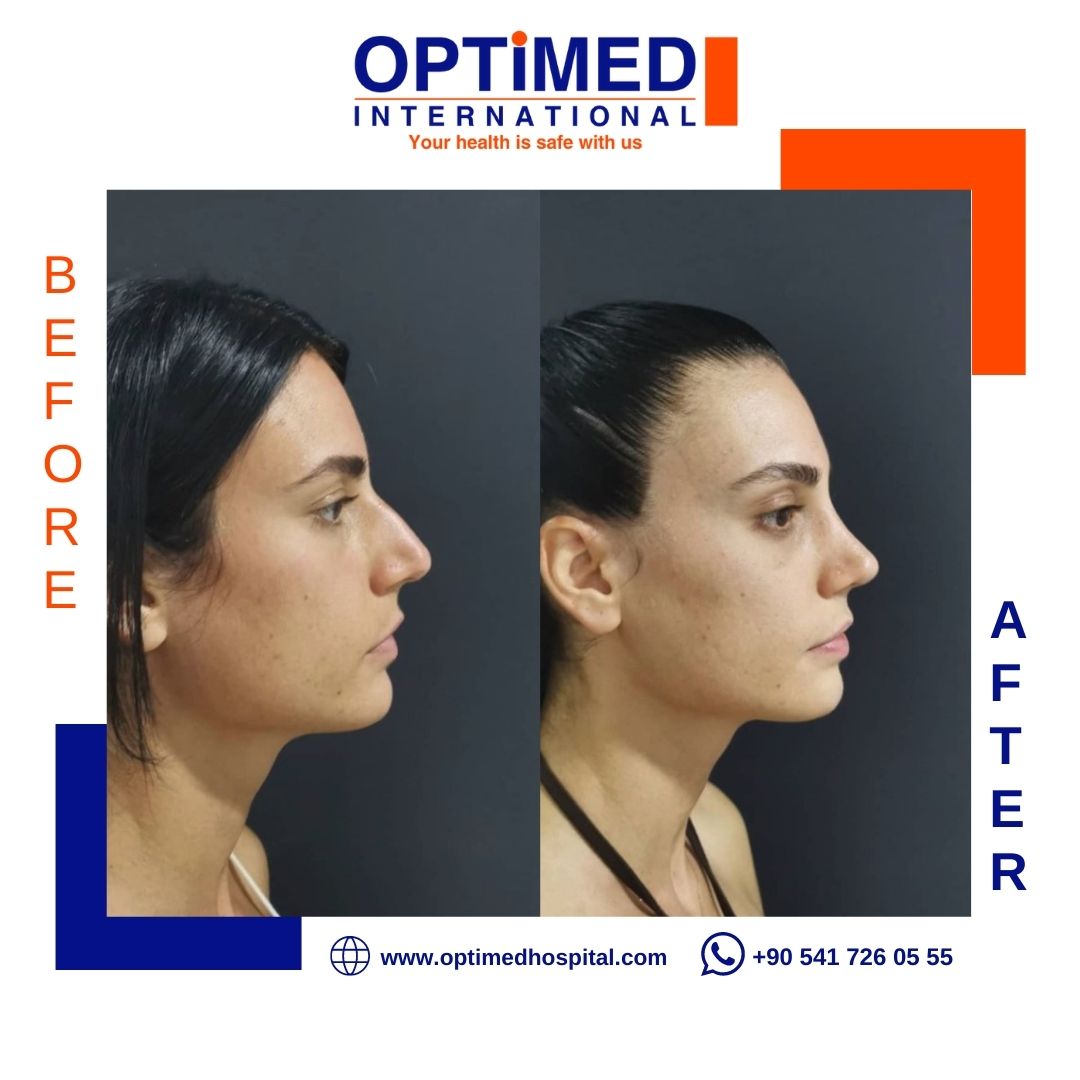 Estetică facială — sonuç 14