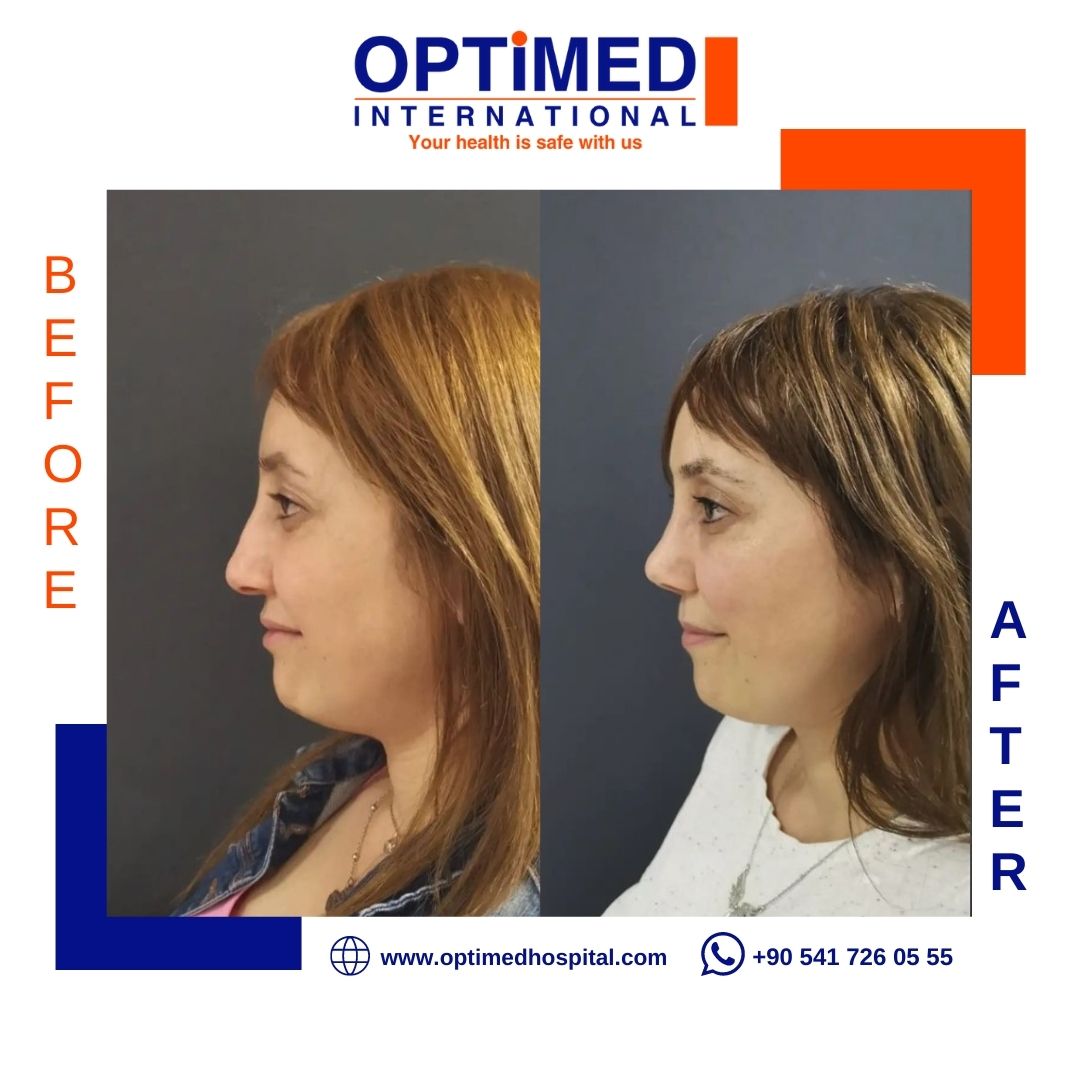 Estetică facială — sonuç 15