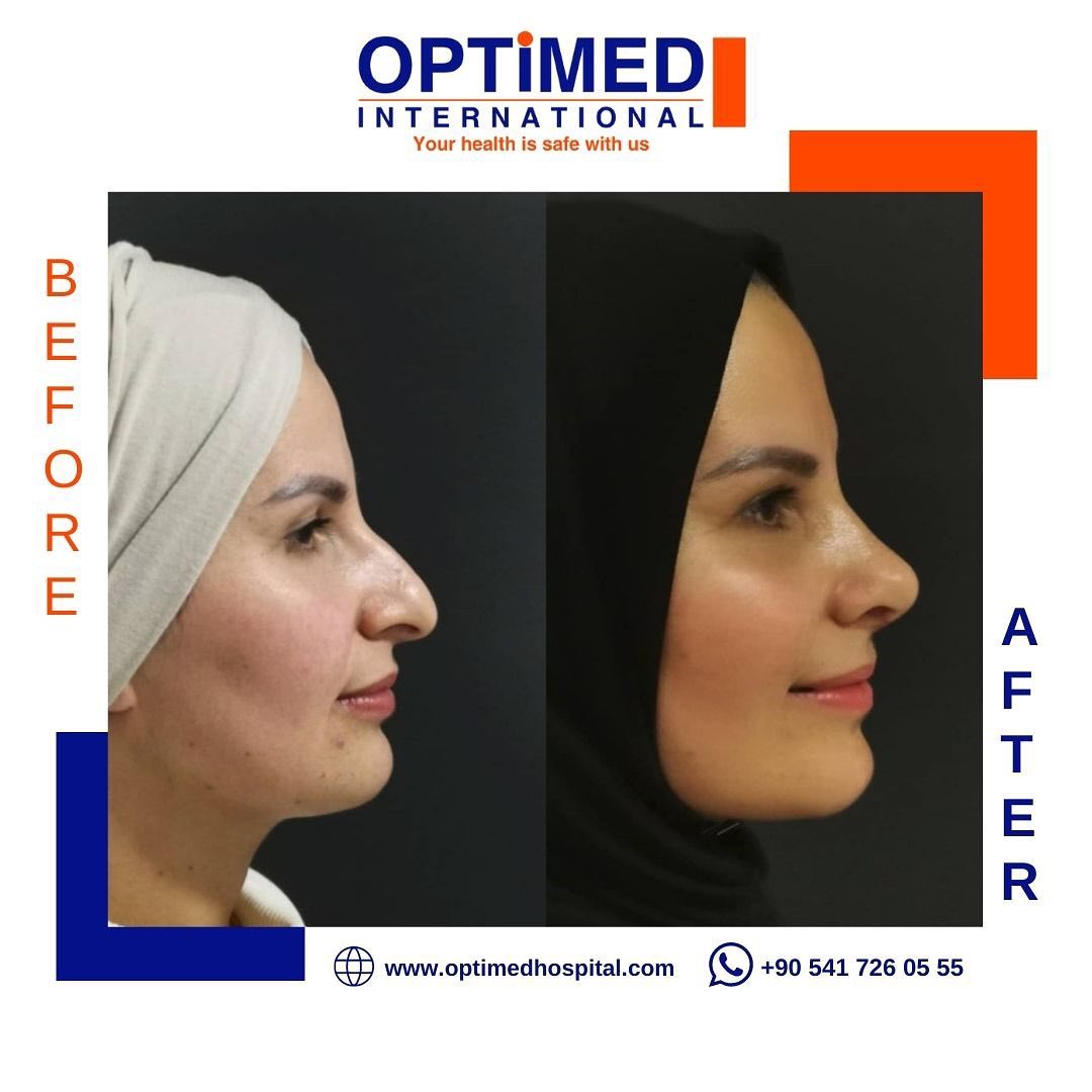 Estetică facială — sonuç 16