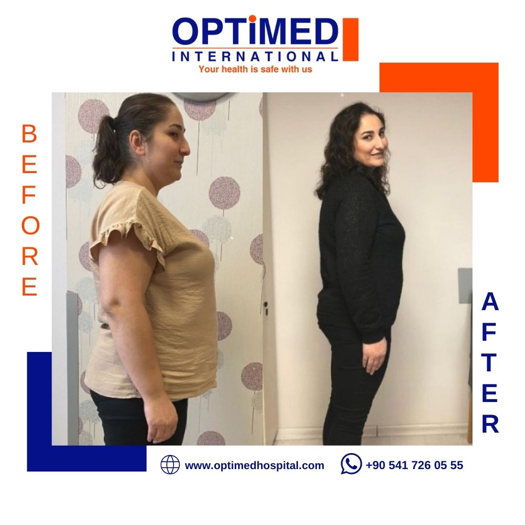 Estetică corporală — sonuç 1