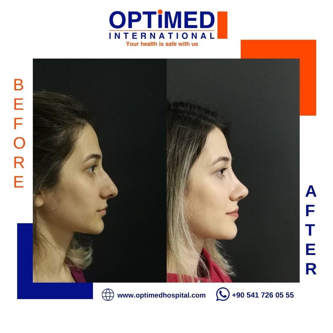 Estetică facială — sonuç 2