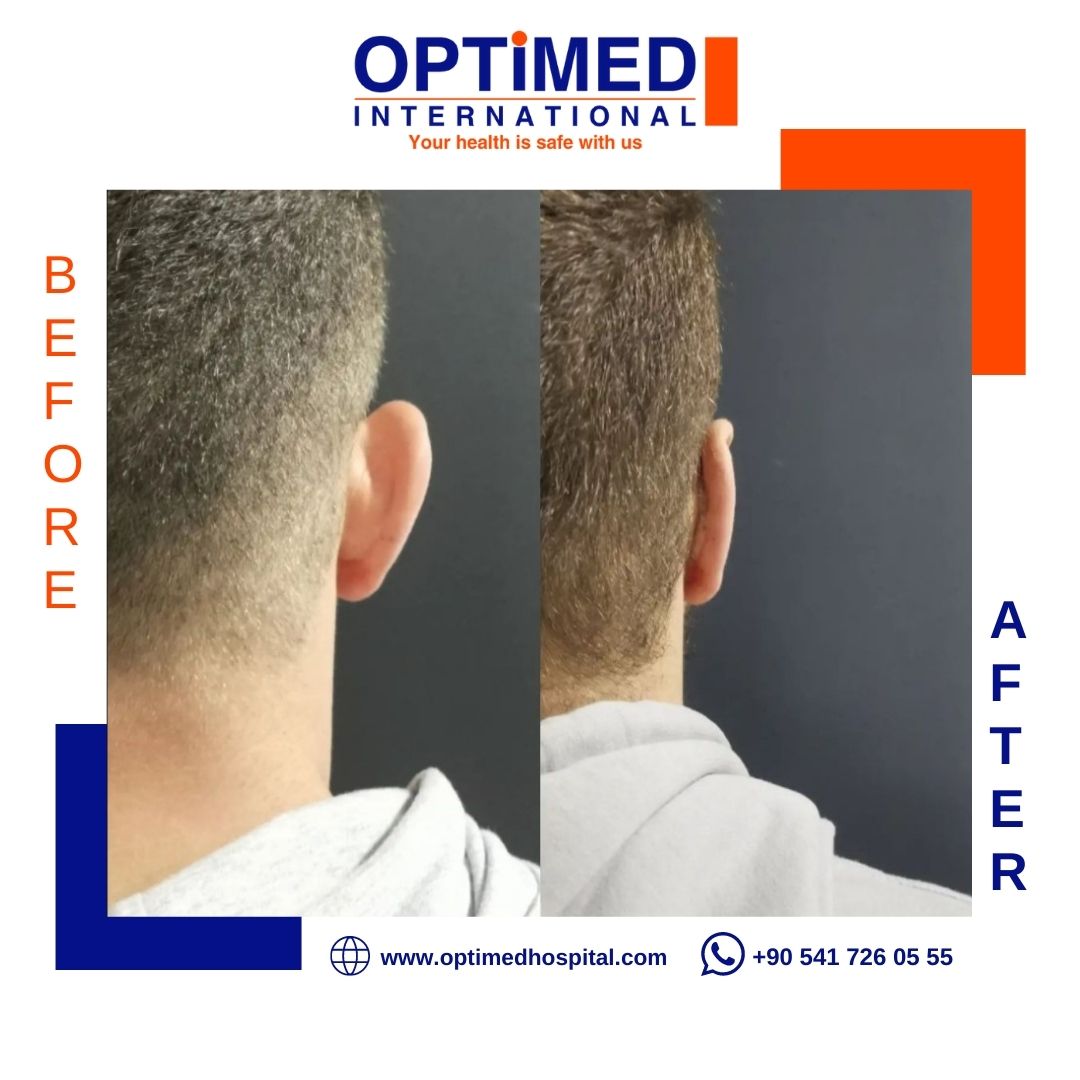 Estetică facială — sonuç 3